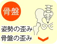 骨盤矯正・姿勢矯正